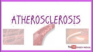 Atherosclerosis made simple [upl. by Read572]