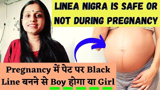 Is it Safe Linea Nigra Duing Pregnancy गर्भावस्था में नाभि पर line बनने से पता करे बेटा है या बेटी [upl. by Dahcir889]