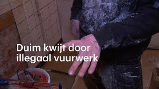 Anthony is zijn duim kwijt door illegaal vuurwerk De wond gaat elk jaar open  RTL NIEUWS [upl. by Ynaoj]