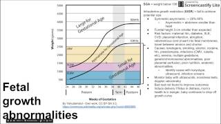 Fetal growth abnormalities [upl. by Aire]