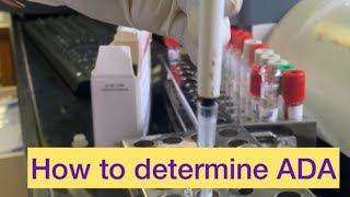 Adenosine Deaminase test for Tuberculosis [upl. by Ynaffi]