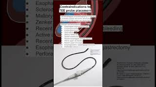 Contraindications to TEE probe placement [upl. by Purington]