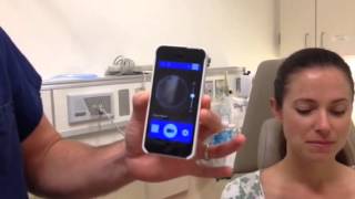 How to use an iPhone Otoscope [upl. by Novhaj]