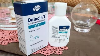 Dalacin T Lotion for acne Review usage Benefit Price Remove Pimples acne best solution for acne [upl. by Shanie]