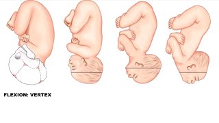 Fetal Skull Diameters Made Easy  Obstetrics [upl. by Anytsyrk]