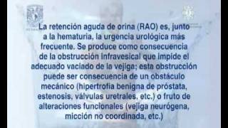 Retención Aguda de Orina [upl. by Ehcar]