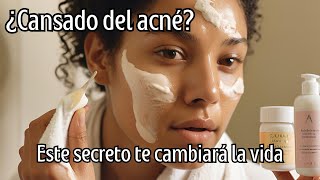 Descubre un remedio natural para reducir el acne [upl. by Nylegna988]