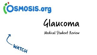 Glaucoma  Clinical Presentation [upl. by Hagep735]