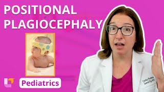 Positional Plagiocephaly Musculoskeletal Disorders  Pediatric Nursing  LevelUpRN [upl. by Hodess]