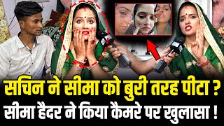 Seema Haider को Sachin ने बुरी तरह पीटा  Seema Haider ने किया कैमरे पर खुलासा  HCN News [upl. by Gniliem]