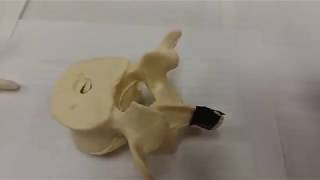 Typical Vertebra Parts 1 of 2 [upl. by Almeeta466]