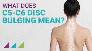 What Does C5C6 Disc Bulging Mean [upl. by Marabel]