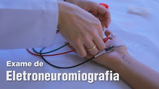 Bioimpedância  O Que é e Como é Feita [upl. by Akirat237]