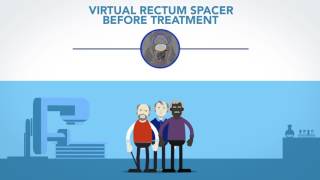 Rectum Spacer in Radiotherapy for Prostate Cancer [upl. by Bannerman]