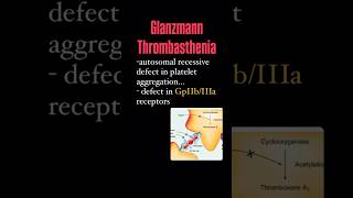 Glanzmaan’s disease and platelet defect platelets plateletcount bleeding hematology neetpg [upl. by Enrev128]