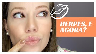 Herpes Labial como curar rapidamente [upl. by Oramlub]