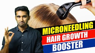 How to do MICRONEEDLING at home for HAIR GROWTHதமிழ் tamil haircare hairgrowth hairloss [upl. by Friend]