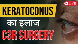 Keratoconus क्या है Keratoconus का क्या इलाज है [upl. by Hammad]