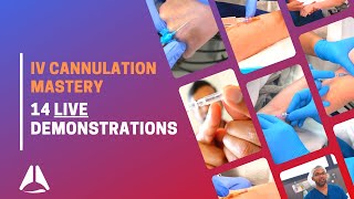 Intravenous IV cannulation compilation with demonstration of 14 procedures [upl. by Kelcie898]