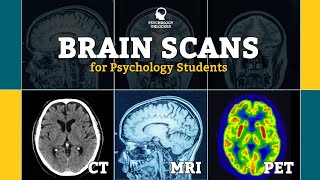 BRAIN SCANS FOR PSYCHOLOGY STUDENTS  CT MRI fMRI PET  Neuroscience [upl. by Aiyt]