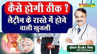 कैसे होगी ठीक लैटिन के रास्ते में होने वाली खुजली hemorrhoids [upl. by Liddle]