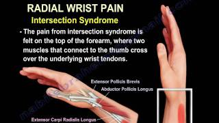 Wrist Paincauses and treatmentPart 2  Everything You Need To Know  Dr Nabil Ebraheim [upl. by Rhodes]