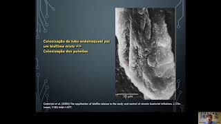 Biofilmes Parte 2 [upl. by Sky]