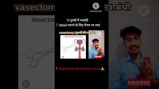 💉नशबंदीvasectomy medical procedureanatomypopularmosttrendingwowviralvideo [upl. by Ahsekin735]