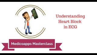 Understanding Heart Block in ECG [upl. by Camp]