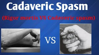 Cadaveric spasm  Difference between Rigor mortis amp Cadaveric spasm [upl. by Enihpled151]