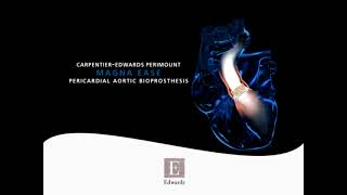 CarpentierEdwards PERIMOUNT Magna Ease aortic valve [upl. by Eisaj50]