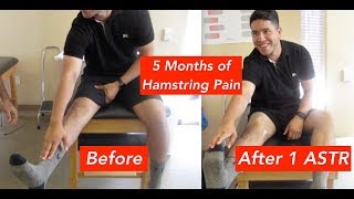 Hamstring Pain amp Tightness Released Before Your Eyes THIS WORKS [upl. by Akiemehs730]