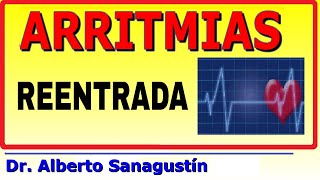 ARRITMIAS 6 REENTRADAS como causa de arritmia cardíaca [upl. by Stace]