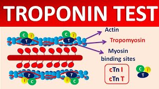 Troponin test and its significance [upl. by Eerac76]