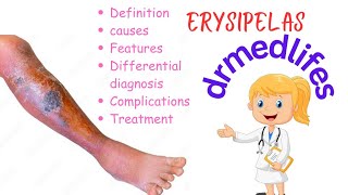 Erysipelas causes symptoms differential diagnosis complications treatment [upl. by Eetsirk]