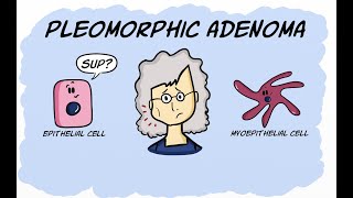 Pleomorphic Adenoma [upl. by Eilime]