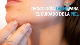 Tecnología láser para quitar manchas en la piel [upl. by Janeta]