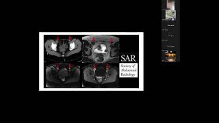 MDampMS Cases Lecture IV [upl. by Mordecai]