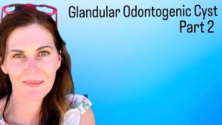 🦷 Whats Going On With My Mouth  Glandular Cyst Part 2 [upl. by Essy]