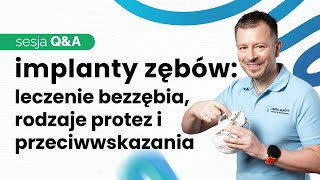 IMPLANTY ZĘBOWE  QampA cz II📣PROTEZY NA 4 I 6 IMPLANTACH PRZECIWWSKAZANIA DO LECZENIA [upl. by Eniamurt]