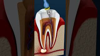 Cavity filling dentist teeth anatomy neet usmlestep [upl. by Vinson]