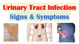 Urinary Tract Infection UTI Signs amp Symptoms amp Why They Occur [upl. by Zacherie]