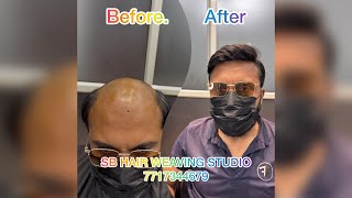 sbhairweavingstudio hairstyle hairwiginahmedabad hairpatchinahmedabad hair [upl. by Alaek274]