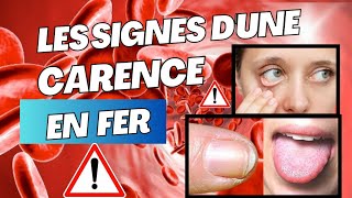 💥 Manque de fer les signes dune carence en fer à ne pas ignorer ‏fer ManqueDeFer anemie [upl. by Gnohp]