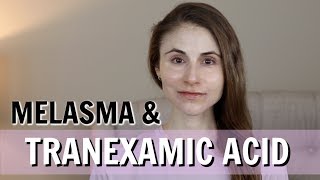 TRANEXAMIC ACID FOR MELASMA PILLS CREAMS INJECTIONS DR DRAY [upl. by Henke]