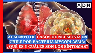 Aumento de casos de neumonía en Chile por bacteria mycoplasma ¿Qué es y cuáles son los síntomas [upl. by Annahahs]