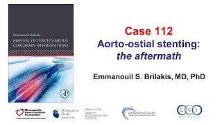 Case 112 PCI Manual  Aortoostial stent challenges [upl. by Huskey384]