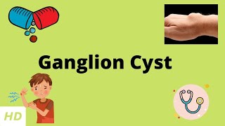 Ganglion Cyst Causes Sign and Symptoms Diagnosis and Treatment [upl. by Shirlene]