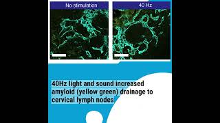 How 40Hz sensory gamma rhythm stimulation clears amyloid in Alzheimers mice [upl. by Kosse]