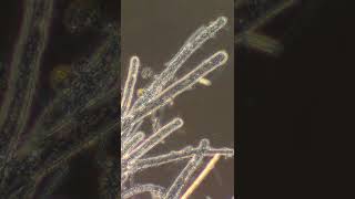 Coenocytic Hyphae [upl. by Aytnahs326]